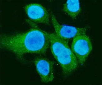 Carbonic Anhydrase I Antibody / CA1