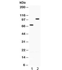 Western blot testing of 1) rat ovary and 2) human SKOV lysate with ZP1 antibody. Expected molecular