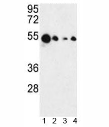 Western blot analysis of AIM2 antibody and 1) MCF-7, 2) HL-60, 3) K562 and 4) HeLa lysate. Predicted