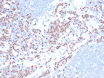 LEF1 Antibody / Lymphoid enhancer-binding factor 1 / TCF1 alpha