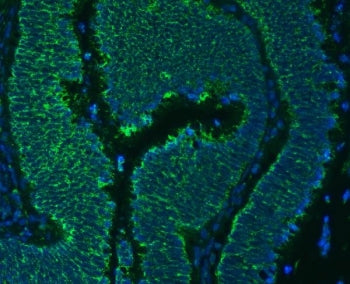 Immunofluorescent staining of FFPE human colon cancer tissue with SLC25A24 antibody (green) and DAPI