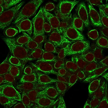 KRT8 Antibody / Cytokeratin 8