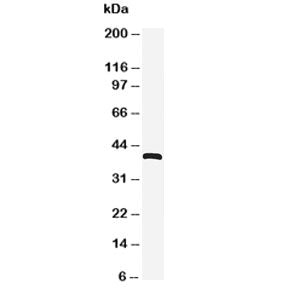 Western blot testing of CXCR4 antibody and HeLa cell lysate. Predicted molecular weight ~40 kDa but