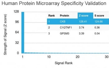 CKB Antibody / Creatine kinase B
