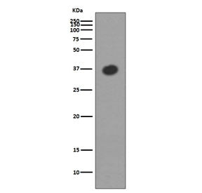Maltose Binding Protein Antibody / malE / MBP tag