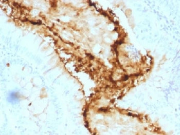 Blood Group Lewis y Antibody