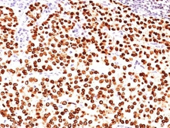 Progesterone Receptor Antibody