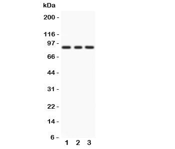 Western blot testing of PKC epsilon antibody and Lane 1: rat brain; 2: Mosue brain; 3: human MCF-7.