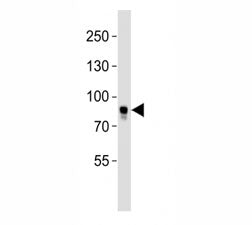 BRAF Antibody