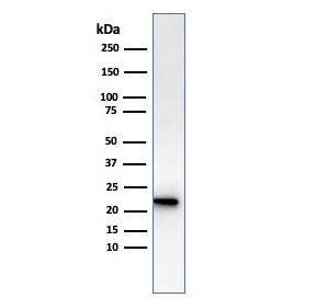 Western blot testing of human kidney lysate with recombinant FTL antibody. Predicted molecular weigh