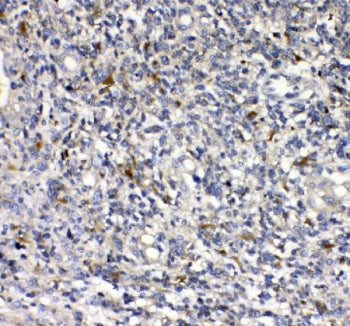 uPAR Antibody uPA Receptor