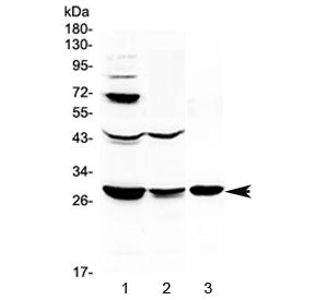 TNFSF15 Antibody / VEGI / TL1A