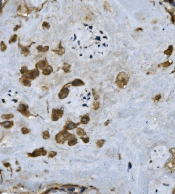 Fibrinogen alpha chain Antibody (FGA)