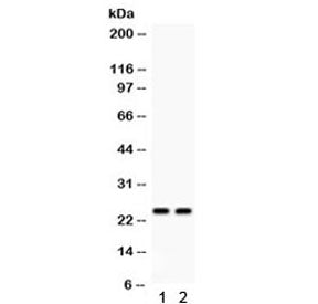 Western blot testing of human 1) A549 and 2) SMMC cell lysate with NGAL antibody at 0.5ug/ml. Predic