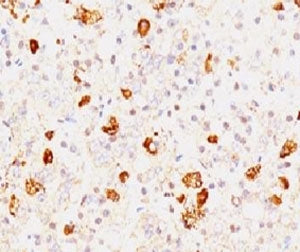 FSH beta Antibody