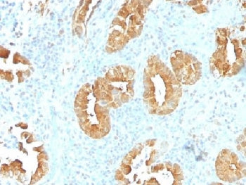 IHC testing of FFPE human rectum tissue with Villin antibody (clone VIL1/1314). Required HIER: boil