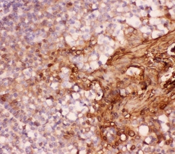 IHC-P: Annexin A1 antibody testing of human tonsil tissue. HIER: boil tissue sections in pH8 EDTA fo