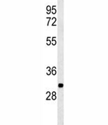 PGP Antibody