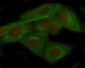 ADAR Antibody / Adenosine deaminase acting on RNA, 100ul