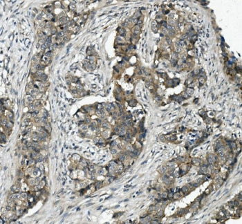 ABCC5 Antibody / MRP5