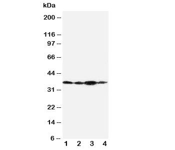 Podoplanin Antibody gp36
