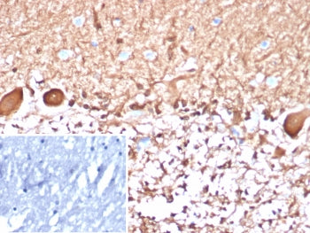 S100B Antibody