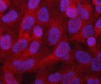 PGAM1 Antibody / Phosphoglycerate mutase 1