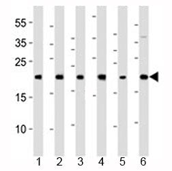 BAX Antibody