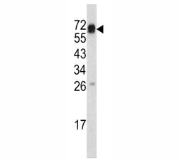 CD105 Antibody