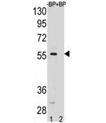 SMAD5 Antibody