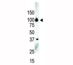 PKC nu Antibody