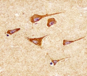 IHC testing of FFPE human brain tissue with Superoxide Dismutase 2 antibody. HIER: steam section in