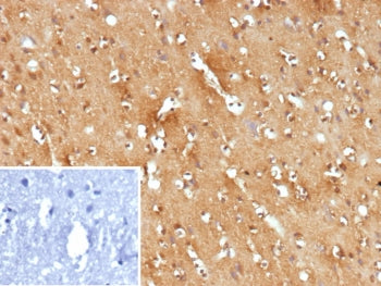 IHC staining of FFPE human brain tissue with Fms-like tyrosine kinase 3 antibody (clone FLT3/9886).