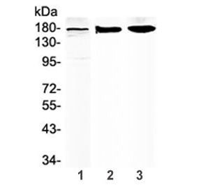 ABCC8 Antibody / SUR1