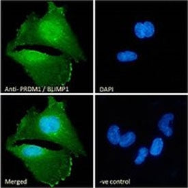 PRDM1 Antibody