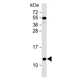 NDUFA2 Antibody (C-Terminal Region)