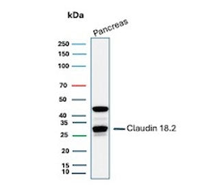 Western blot testing of human pancreas tissue lysate with Claudin18.2 antibody. Predicted molecular