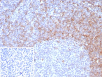 IgD Heavy Chain Antibody