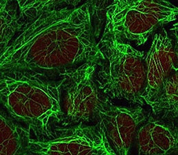 KRT7 Antibody / Cytokeratin 7