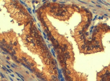 ABCC4 Antibody