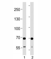 SDHA Antibody