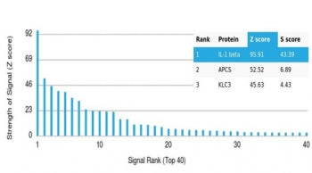 IL1 beta Antibody / IL1B