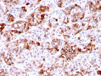 IHC testing of FFPE human pituitary tissue with Prolactin antibody (clone PRL/2644). Required HIER:
