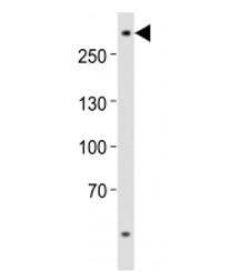 Western blot analysis of lysate from U-87 MG cell line using ABCA2 antibody at 1:1000. Predicted mol
