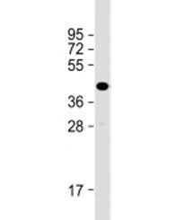 TMEM115 Antibody / PL6