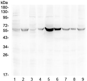 Estrogen Receptor beta Antibody
