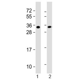 SLUG Antibody (SNAI2)