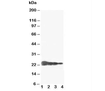 Growth Hormone Antibody (Human)