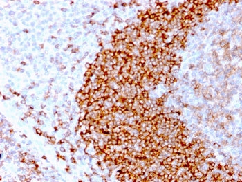 CD79b Antibody