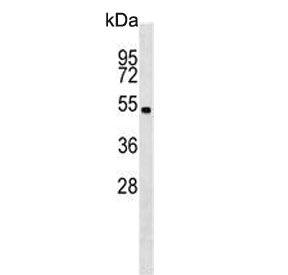 Lkb1 Antibody / Liver kinase b1 / Stk11